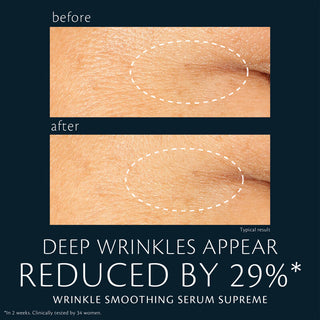 Wrinkle Smoothing Serum Supreme - NEW